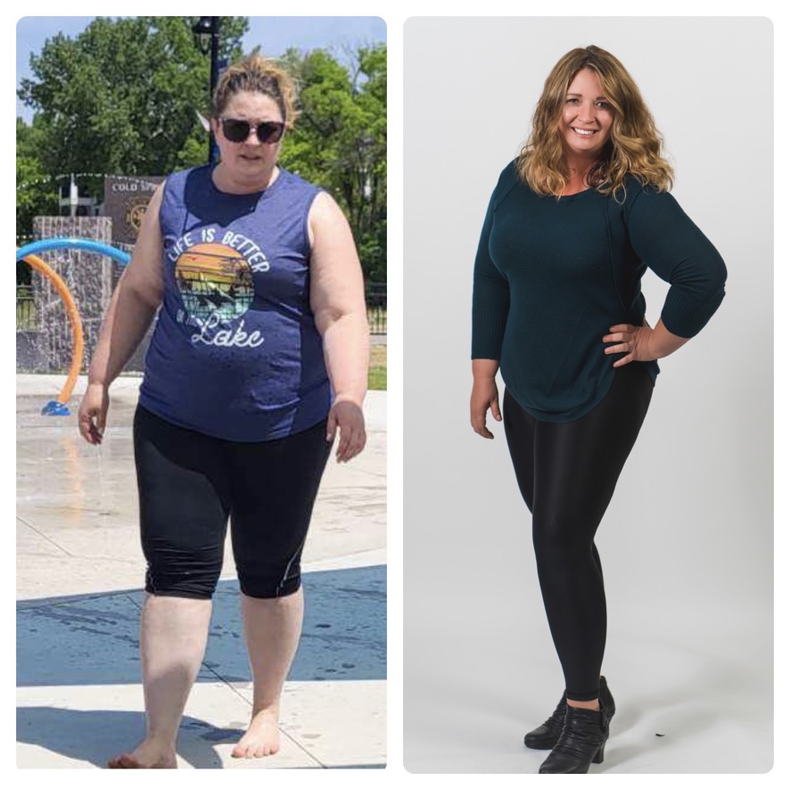 before-after2